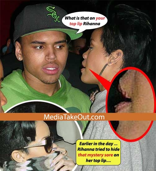 Did Rihanna Give Chris Brown Herpes Did Rihanna Give Chris Brown Herpes